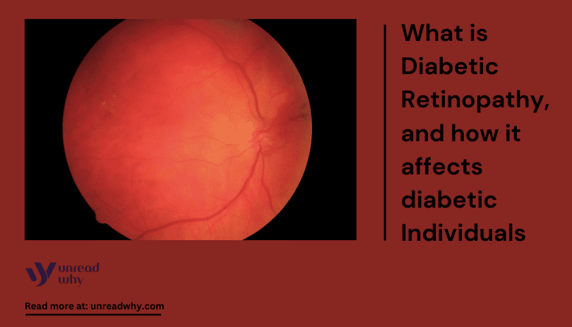 Diabetic retinopathy