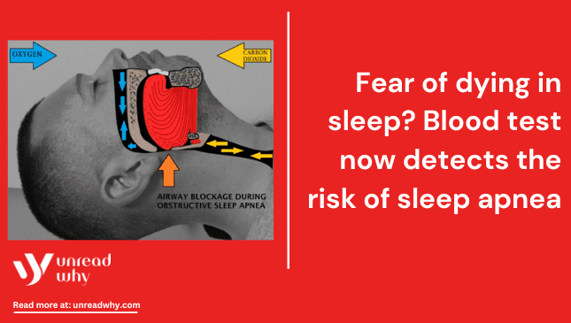 Fear of dying in sleep Blood test now detects the risk of sleep apnea