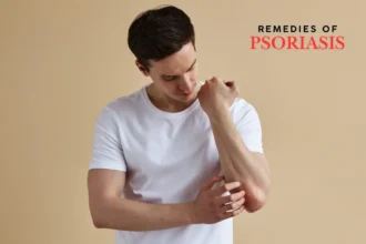 Psoriasis