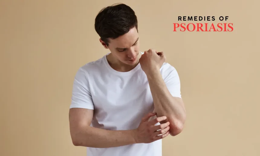 Psoriasis