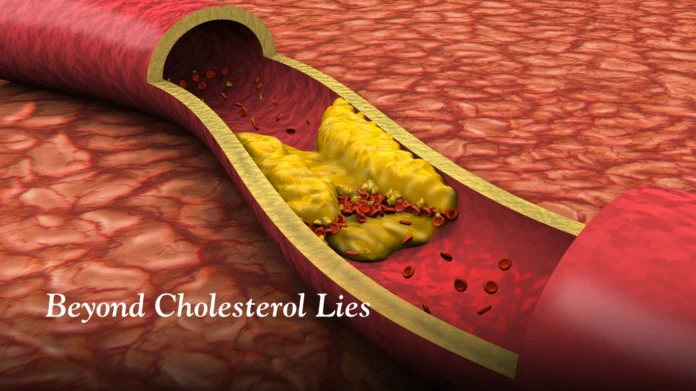 Normal Cholesterol Does Not Guarantee Healthy Heart Hidden Risks Revealed Normal Cholesterol Does Not Guarantee Healthy Heart Hidden Risks Revealed